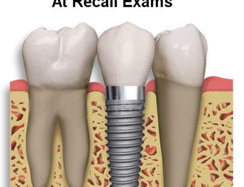 Assessing Dental Implants at Recalls